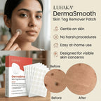 DermaSmooth - Tag & Mole Remover (BUY 1 GET 1 FREE)